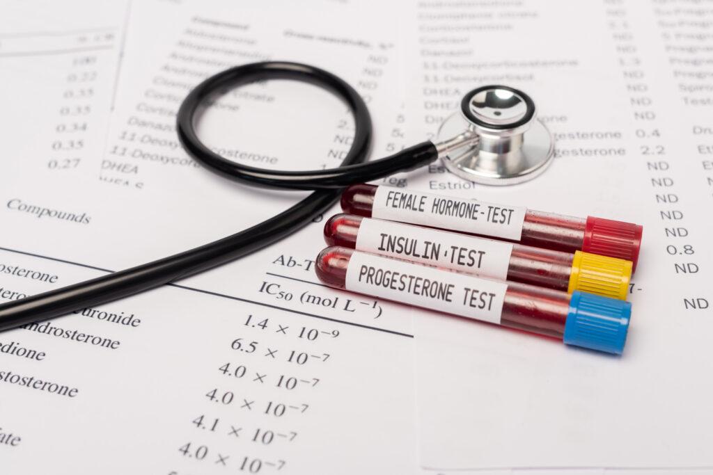 Female Hormone Blood Test Samples