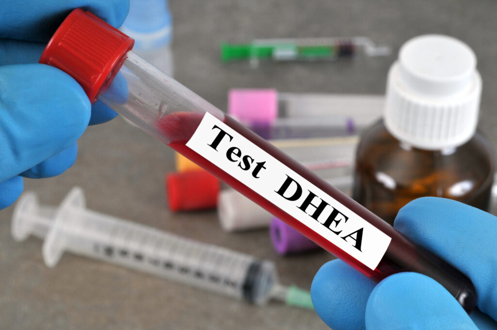 DHEA analysis blood tube hand closeup